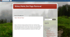 Desktop Screenshot of moleswartsskintagsremovalreview.blogspot.com