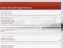 Tablet Screenshot of moleswartsskintagsremovalreview.blogspot.com