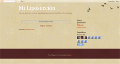 Desktop Screenshot of miliposuccion.blogspot.com
