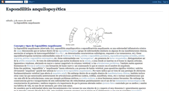 Desktop Screenshot of espondilitisanquilopoyetica.blogspot.com