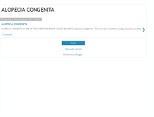 Tablet Screenshot of alopeciacongenita.blogspot.com