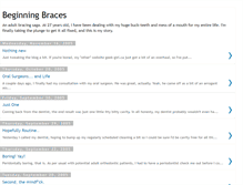 Tablet Screenshot of beginningbraces.blogspot.com