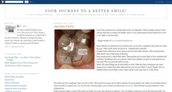 Desktop Screenshot of joondental.blogspot.com