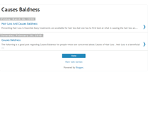 Tablet Screenshot of causesbaldness.blogspot.com