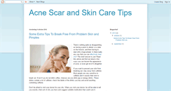 Desktop Screenshot of acnescarsremovaltips.blogspot.com
