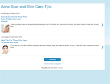 Tablet Screenshot of acnescarsremovaltips.blogspot.com