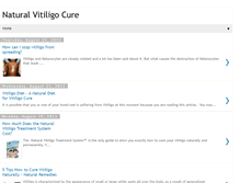 Tablet Screenshot of natural-vitiligo-cure-info.blogspot.com