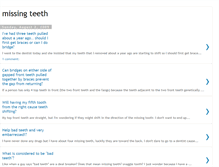 Tablet Screenshot of missing-teeth.blogspot.com