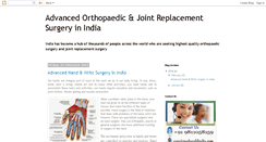 Desktop Screenshot of jointreplacementsurgeryinindia.blogspot.com