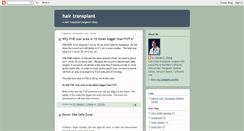 Desktop Screenshot of hairtransplantion.blogspot.com