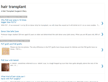 Tablet Screenshot of hairtransplantion.blogspot.com