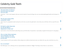 Tablet Screenshot of 8gold-teeth.blogspot.com