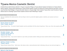 Tablet Screenshot of mexico-cosmetic-dentist.blogspot.com