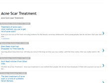 Tablet Screenshot of acnescartreatmentblog.blogspot.com