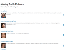 Tablet Screenshot of missingteethpictures.blogspot.com