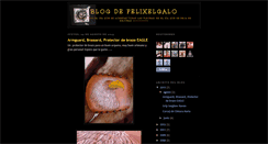 Desktop Screenshot of felixelgalo.blogspot.com