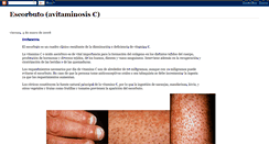Desktop Screenshot of escorbutoavitaminosisc.blogspot.com