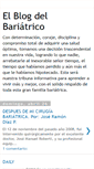 Mobile Screenshot of lacirugiabariatricaynutrilite.blogspot.com