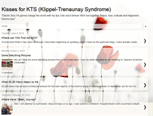 Tablet Screenshot of kissesforkts.blogspot.com