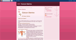 Desktop Screenshot of cancer-cerute.blogspot.com