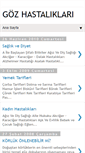 Mobile Screenshot of gozhastaligleri.blogspot.com