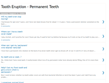 Tablet Screenshot of 4permanent-teeth.blogspot.com