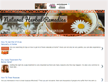 Tablet Screenshot of naturalherbalremediesathome.blogspot.com