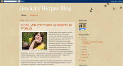 Desktop Screenshot of myherpes.blogspot.com