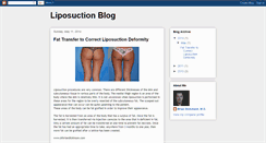 Desktop Screenshot of liposuction-dickinson.blogspot.com