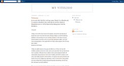 Desktop Screenshot of my-vitiligo.blogspot.com