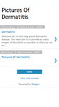 Mobile Screenshot of dermatitis-pictures.blogspot.com