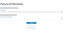 Tablet Screenshot of dermatitis-pictures.blogspot.com