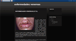 Desktop Screenshot of etsvenereas.blogspot.com