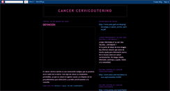 Desktop Screenshot of cancercervicouterinojgf.blogspot.com
