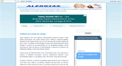 Desktop Screenshot of alergia-tipos.blogspot.com