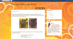 Desktop Screenshot of kieratattooremoval.blogspot.com