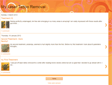 Tablet Screenshot of kieratattooremoval.blogspot.com