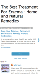 Mobile Screenshot of eczemanaturalremedies.blogspot.com