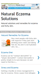 Mobile Screenshot of naturaleczemasolutions.blogspot.com