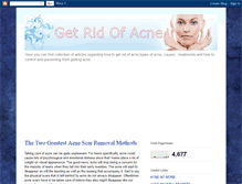 Tablet Screenshot of getridof-acne.blogspot.com