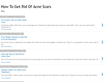 Tablet Screenshot of howtogetridof-acne-scars.blogspot.com