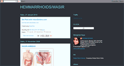 Desktop Screenshot of hemmarrhoids.blogspot.com