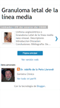 Mobile Screenshot of granulomaletallineamedia.blogspot.com