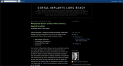 Desktop Screenshot of dentalimplantslongbeach90807.blogspot.com
