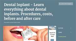 Desktop Screenshot of dental-inplants.blogspot.com