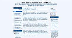 Desktop Screenshot of bestacnetreatment11.blogspot.com