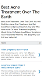 Mobile Screenshot of bestacnetreatment11.blogspot.com