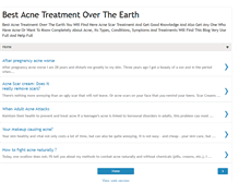 Tablet Screenshot of bestacnetreatment11.blogspot.com