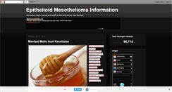 Desktop Screenshot of mesothelioma-epithelioid.blogspot.com