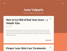 Tablet Screenshot of acne-vulgaris-causes.blogspot.com